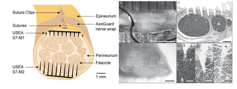 马斯克脑植入芯片_通过脑机接口实现医疗突破：马斯克宣布2025年Neuralink的植入计划_大脑植入设备